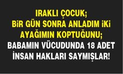Iraklı çocuk; Bir gün sonra anladım iki ayağımın koptuğunu; Babamın vücudunda 18 adet insan hakları saymışlar!