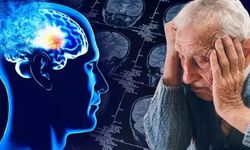 Alzheimer’da yeni tanı yöntemi tartışma yarattı… Milyonlarca sağlıklı insana teşhis konabilir!