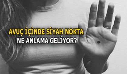 AVUÇ İÇİNDE SİYAH NOKTA NE ANLAMA GELİYOR?