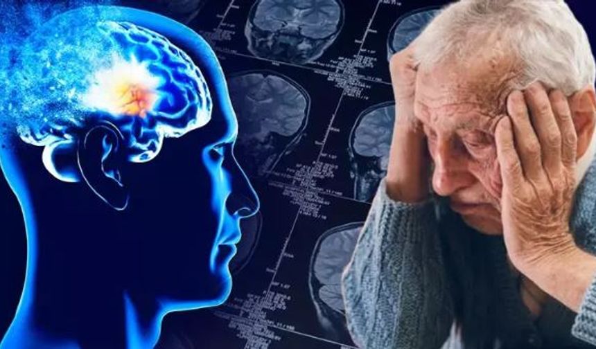 Alzheimer’da yeni tanı yöntemi tartışma yarattı… Milyonlarca sağlıklı insana teşhis konabilir!
